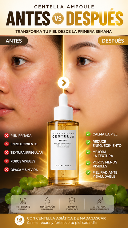Centella Madagascar Capsule Ampoule 30ml